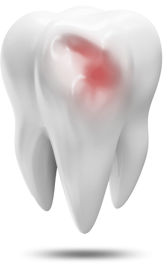 tooth model Waterford, CT